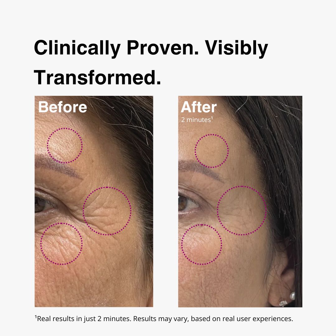 lift+ anti aging serum by rawnaqy results