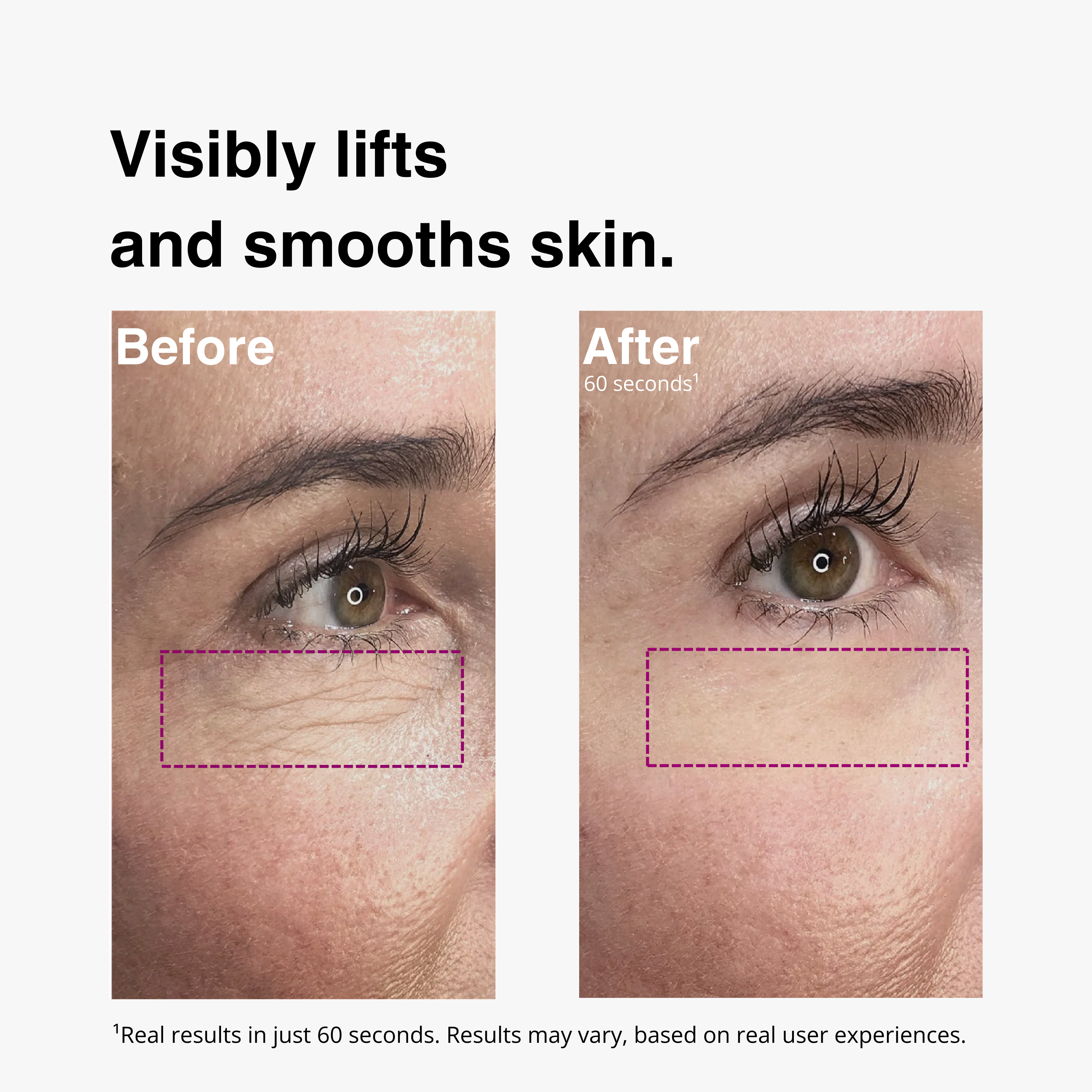 Before and after comparison of skin lifting and smoothing after using LIFT+ with text 'Visibly lifts and smooths skin'.