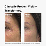lift+ anti aging serum by rawnaqy results